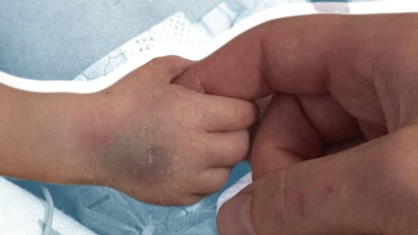 У Борисполі дворічна дитина постраждала від уламків під час ворожої атаки